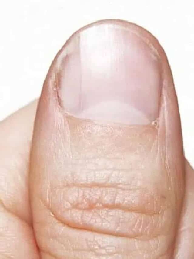 Meaning Of White Half Moon Of Nail In Hindi