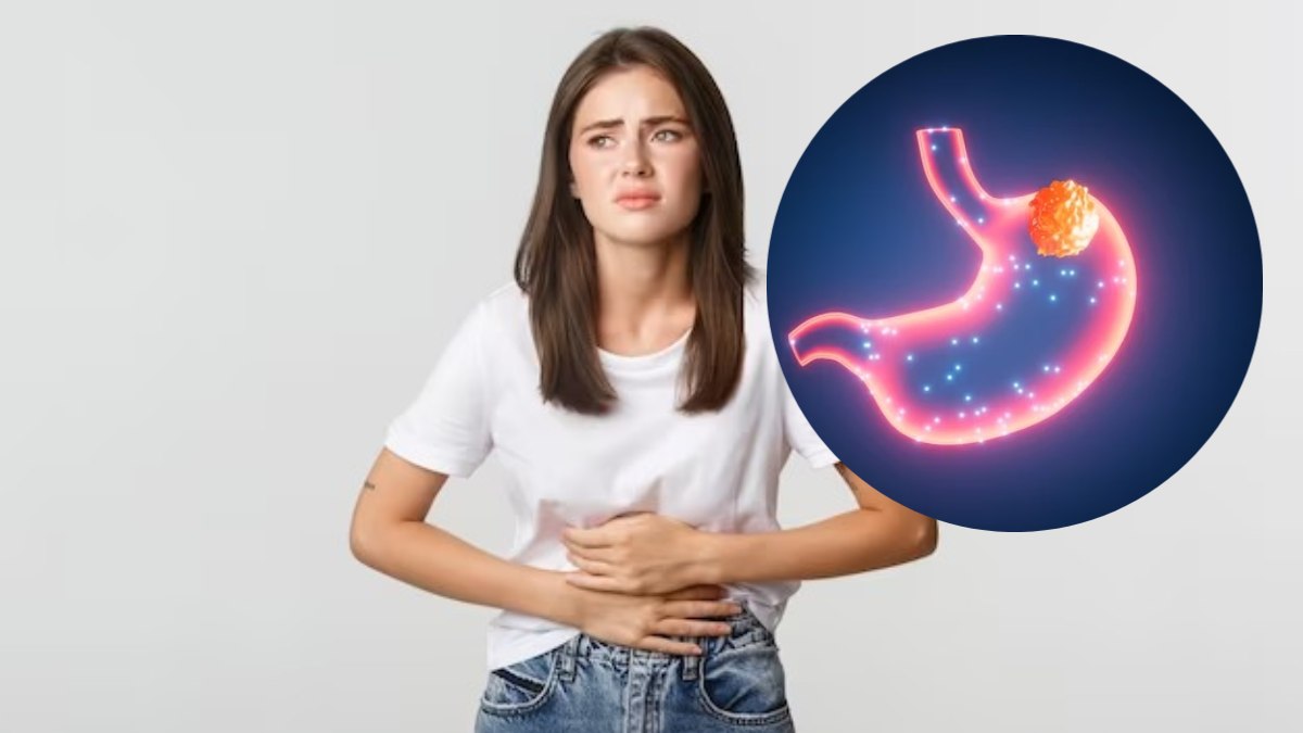 5 symptoms of stomach cancer, know how prevention can be done